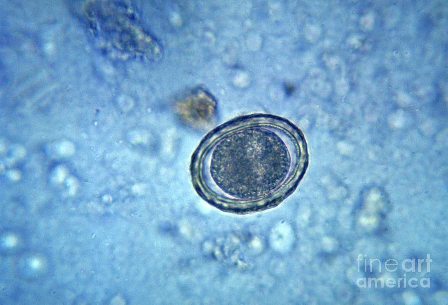 Fertilized Ascaris Lumbricoides Egg Photograph by Cdc/ Dr. Mae Melvin ...