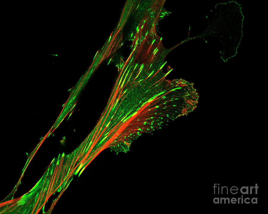 Fibroblast Cell Photograph by Stefanie Reichelt/science Photo Library