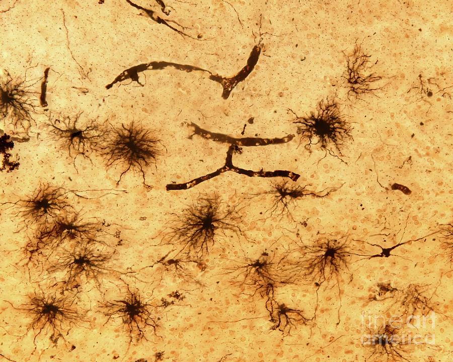 Fibrous Astrocytes Photograph by Jose Calvo / Science Photo Library