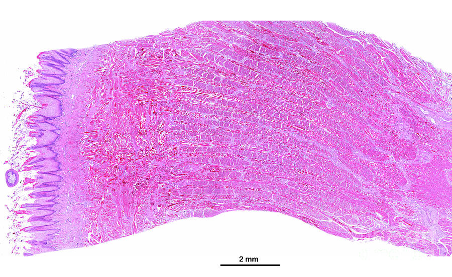 Filiform Papillae Photograph by Jose Calvo / Science Photo Library