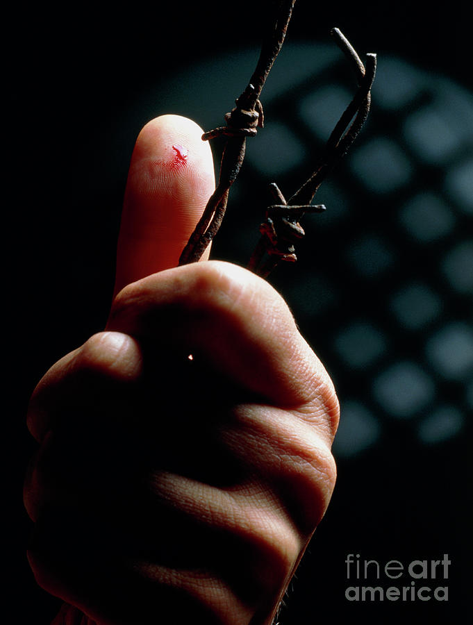 Finger Pricked On Barbed Wire: Cause Of Tetanus Photograph by Oscar Burriel/science Photo Library