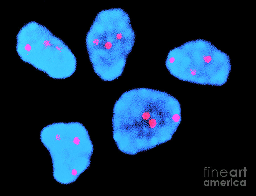 Fish Micrograph Of Chromosomes In Downs Syndrome Photograph by Dept. Of Clinical Cytogenetics, Addenbrookes Hospital/science Photo Library