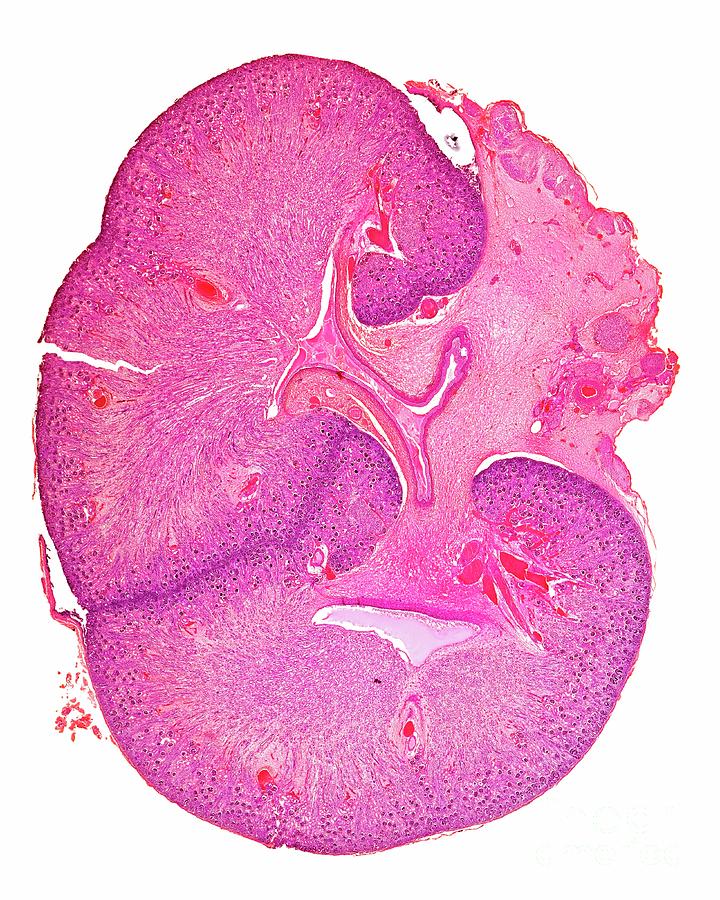 Foetal Kidney Photograph by Dr Keith Wheeler/science Photo Library
