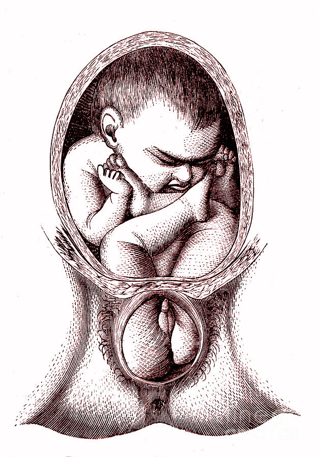 Foetal Position Photograph by Science Photo Library Foetal Position Photograph by Science Photo Library