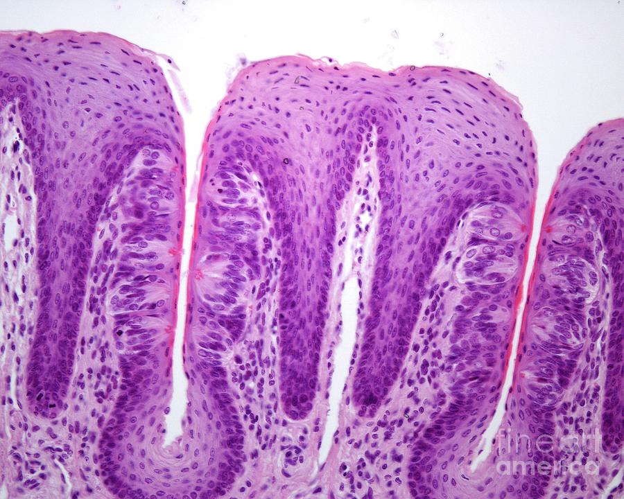 Foliate Papillae With Taste Buds Photograph by Jose Calvo / Science Photo Library
