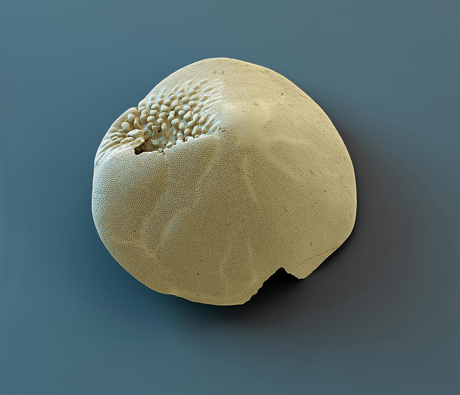 Foraminiferan Amphistegina Lessonii, Sem Photograph by Oliver Meckes EYE OF SCIENCE