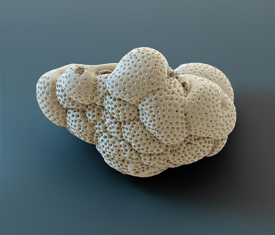 Foraminiferan Cymbaloporetta Bradyi, Sem Photograph by Oliver Meckes EYE OF SCIENCE