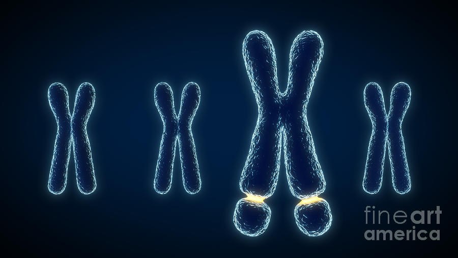 Fragile X Chromosome Photograph by Thom Leach / Science Photo Library ...