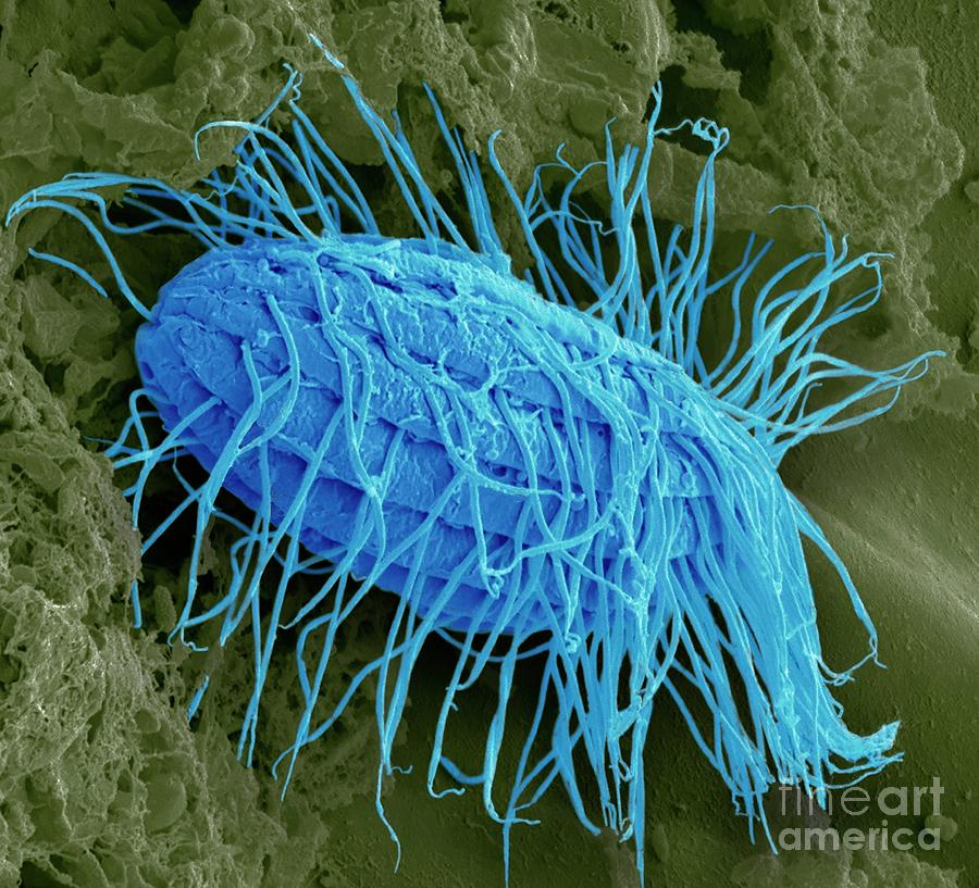 Fresh Water Ciliate Protozoan Photograph by Steve Gschmeissner/science Photo Library