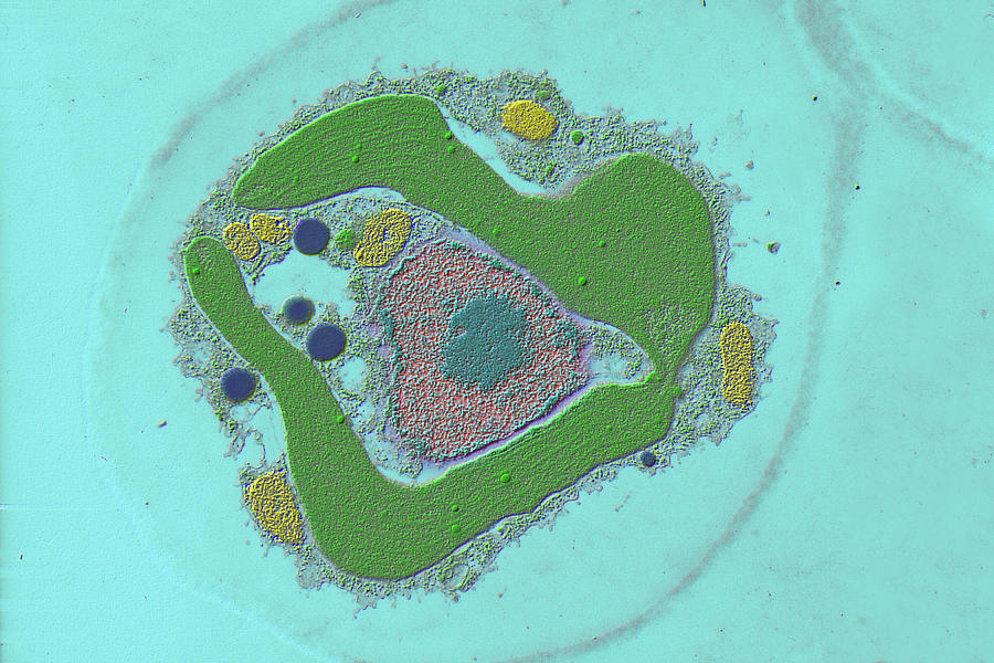Freshwater Algae, Dinobryon Sp., Tem Photograph by Johnny Carson