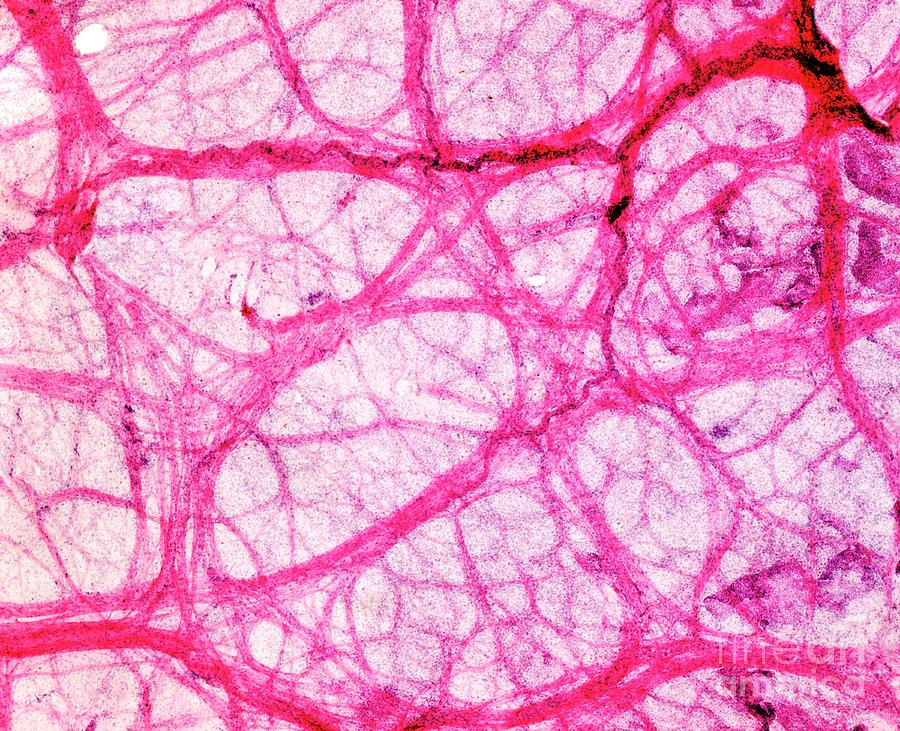 Frog Bladder Tissue Photograph by Dr Keith Wheeler/science Photo Library