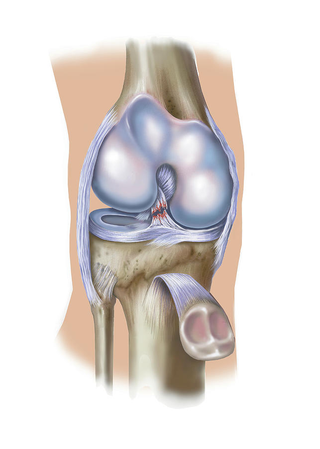 Front View Of Knee Showing Anterior Photograph by Elise Walmsley Mac-Wha