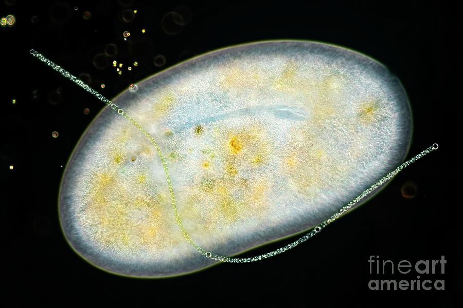 Frontonia Sp. Protist Eats Algae Photograph by Frank Fox/science Photo Library