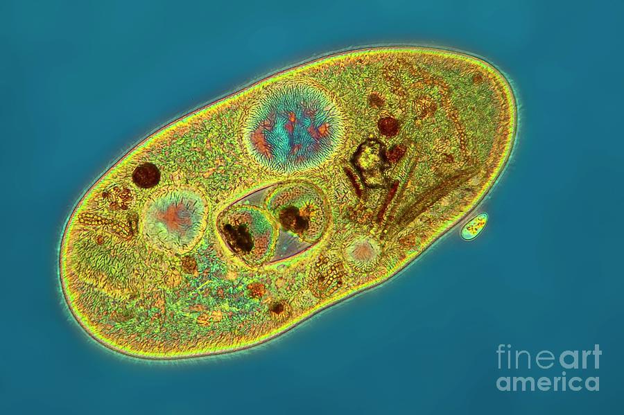 Frontonia Sp. Protist  Photograph by Frank Fox/science Photo Library