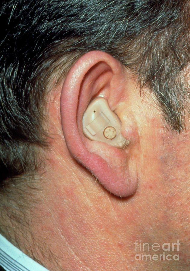 Full Concha Hearing Aid In Mans Ear Photograph by Jane Shemilt/science Photo Library