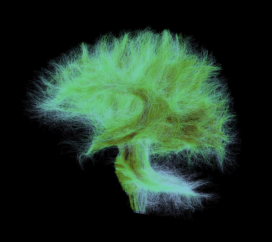 Color Digital Art - Full Human Brain Fibers. Side View With Fibers Coming From The Spinal Cord And Cerebellum. The Darker The Color, The Denser The Fibers by Sherbrooke Connectivity Imaging Lab (scil)