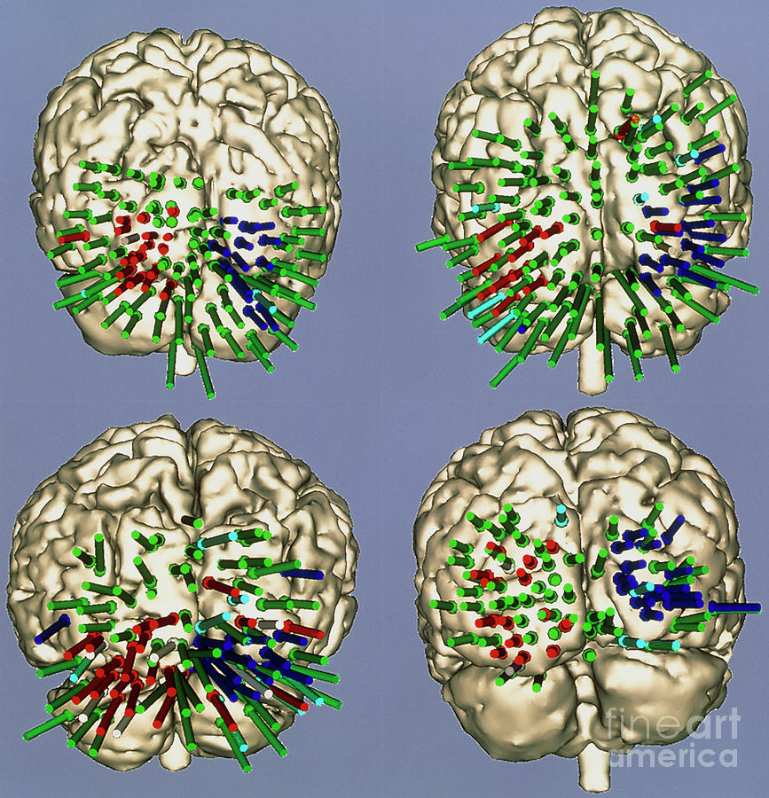 Functional Map Of The Brains Visual Cortex Areas Photograph by Mit Ai Lab/surgical Planning Lab/brigham & Womens Hospital/science Photo Library