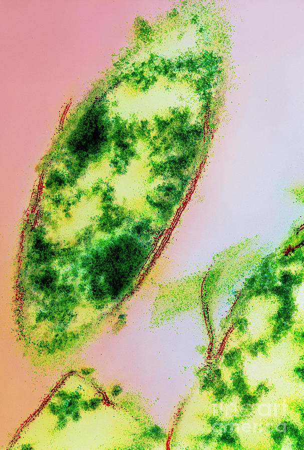 Fusobacterium Nucleatum Bacteria Photograph By Dr Kari Lounatmaa