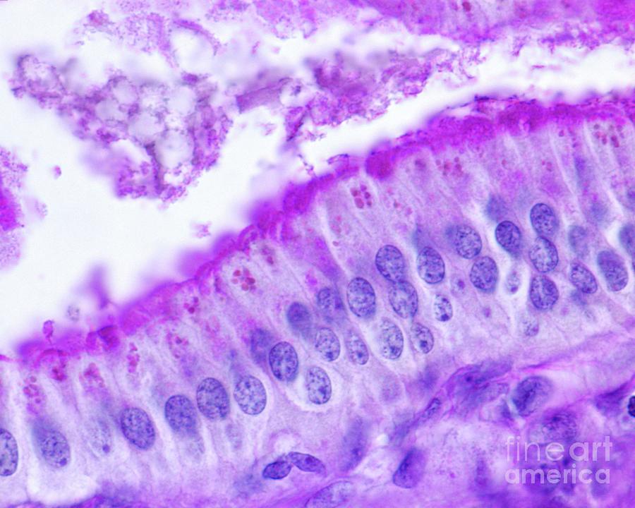 Gallbladder Epithelium Photograph by Jose Calvo / Science Photo Library ...