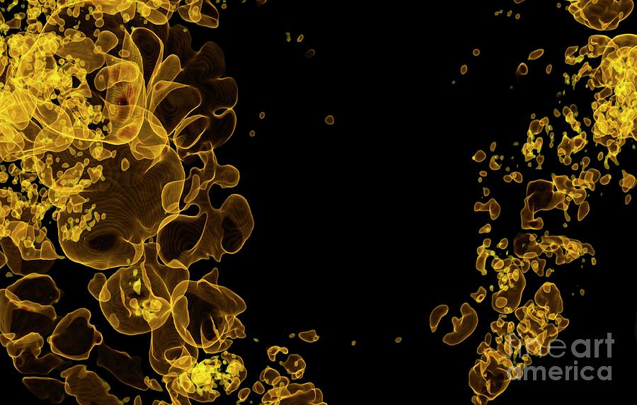 Gas In The Intestines Photograph by Vsevolod Zviryk/science Photo