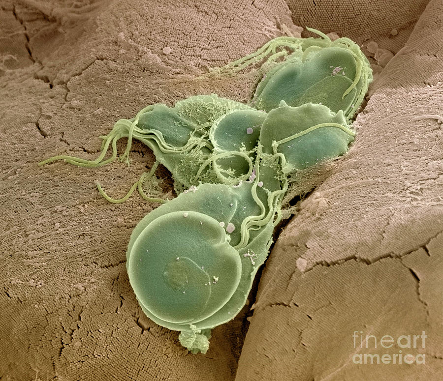 Giardia Lamblia Protozoa Photograph By Dr Tony Brainscience Photo Library Fine Art America 5797