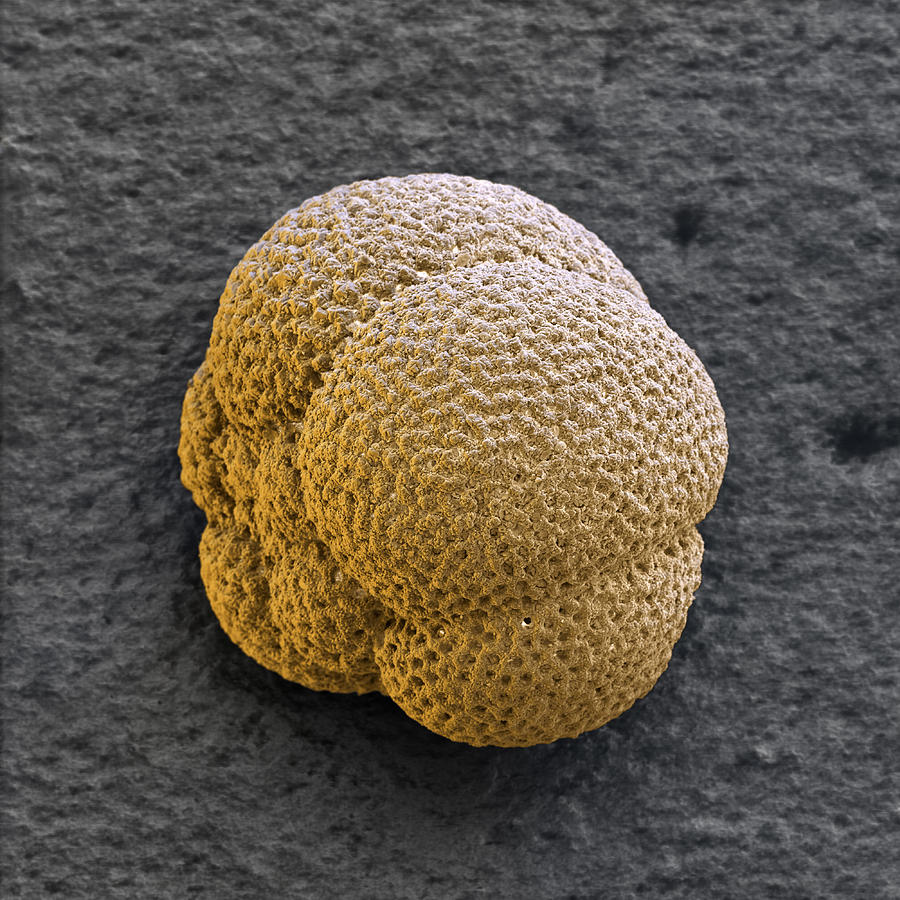 Globigerina Foraminiferan Photograph by Meckes/ottawa