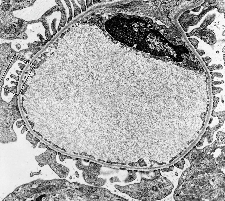 Glomerular Capillary, Tem Photograph by Don Fawcett