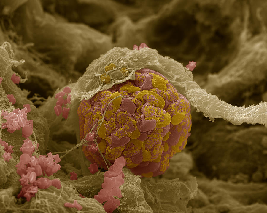 Glomerulus In Kidney Photograph by Meckes/ottawa