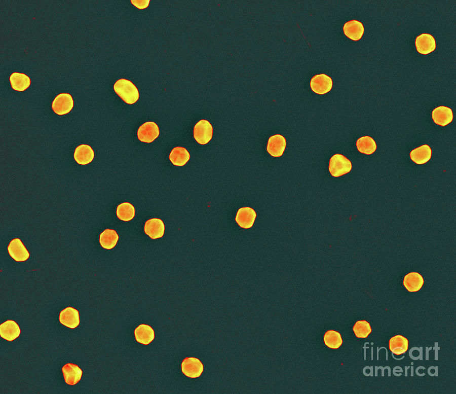 Nanoparticle Photograph - Gold Nanoparticles by Andras Vladar/national Institute Of Standards And Technology/science Photo Library