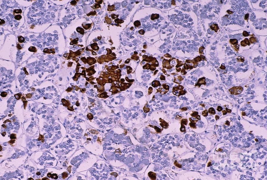 Growth Hormone In Anterior Pituitary Gland Photograph By Jose Calvo