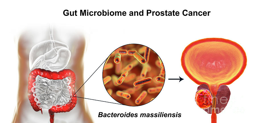 Dimensional Photograph - Gut Microbiome And Prostate Cancer by Kateryna Kon/science Photo Library