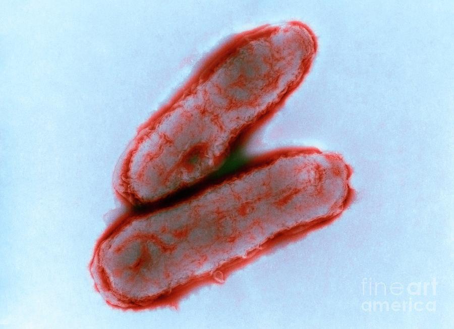 Haemophilus Influenzae Bacteria Photograph by A. Dowsett, National ...