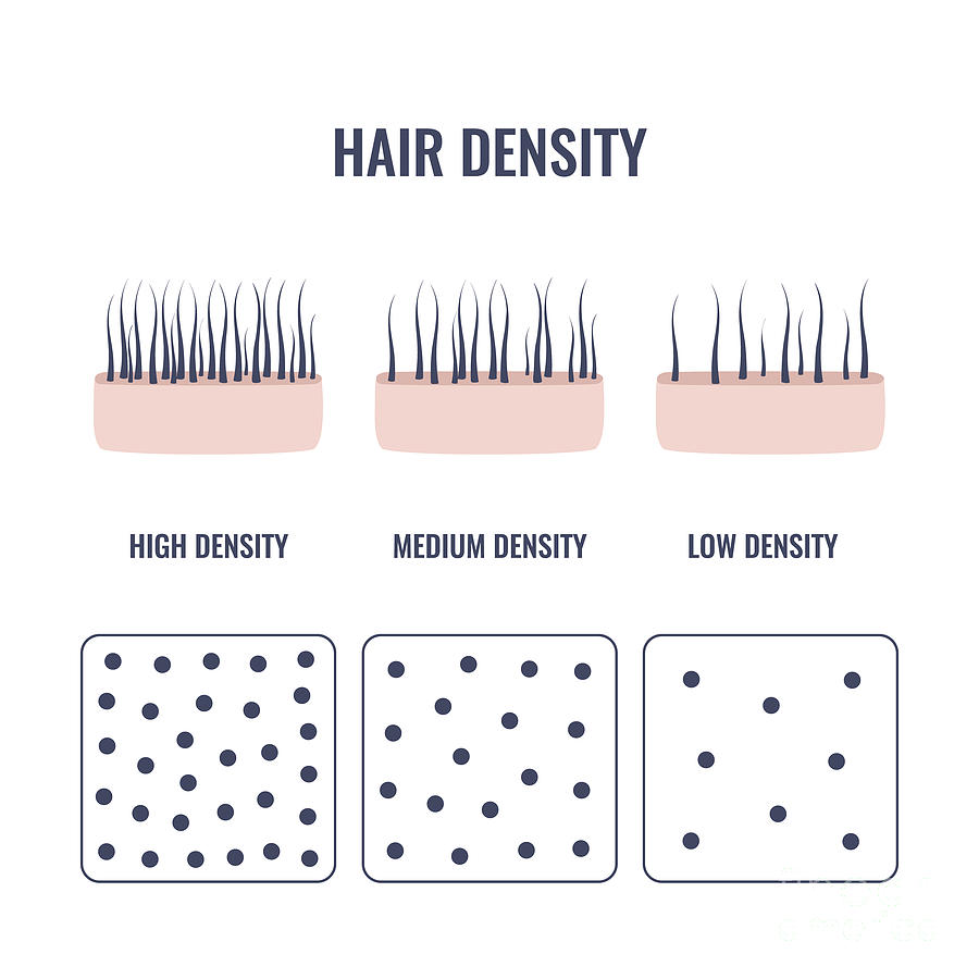 Hair Density Types Photograph by Art4stock/science Photo Library