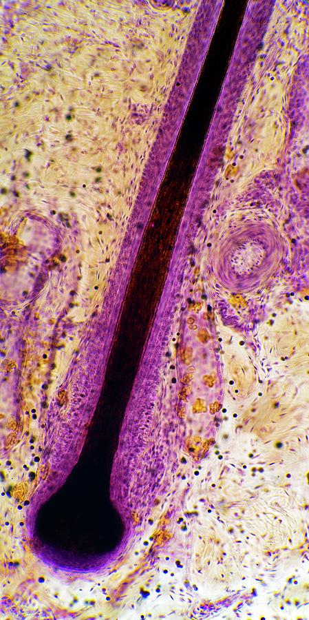 Hair Follicle Photograph by Dr Keith Wheeler/science Photo Library