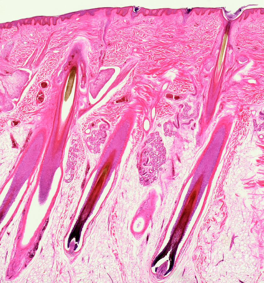 Hair Shaft And Follicles Photograph by Nigel Downer/science Photo Library