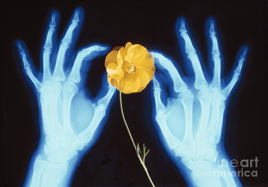 Hands And Flower Photograph by Oscar Burriel/science Photo Library