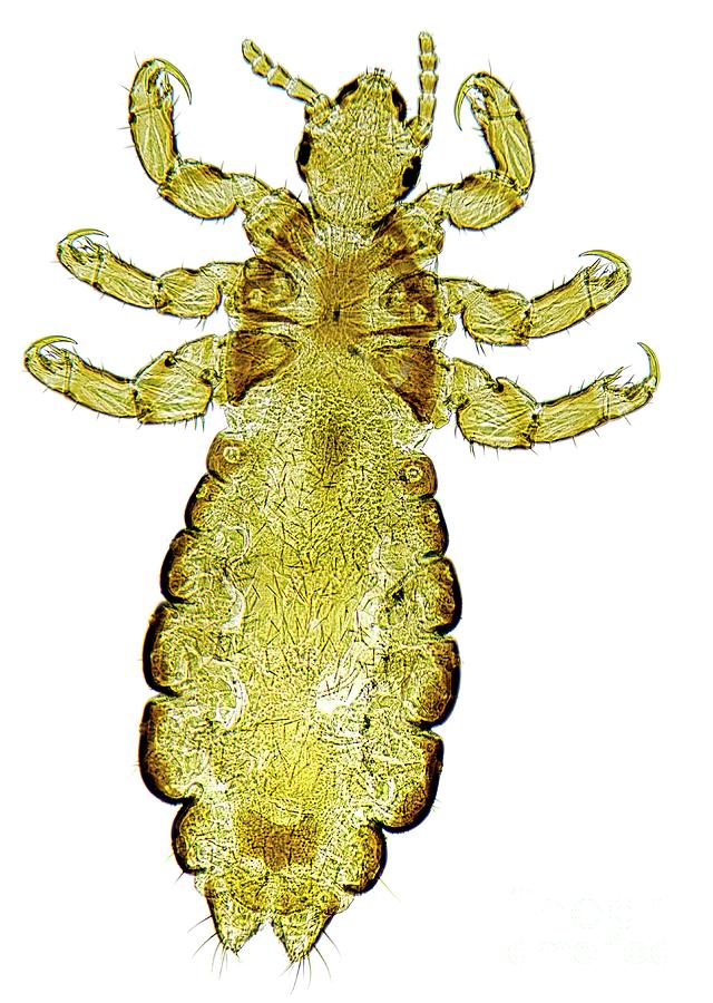 Head Louse Photograph by Dr Keith Wheeler/science Photo Library