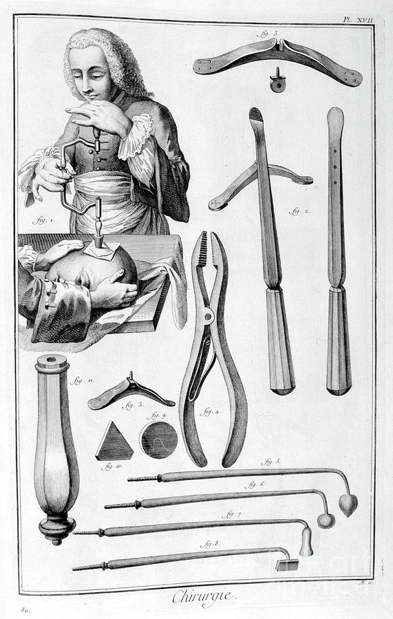 Head Surgery, 1751-1777 Drawing by Print Collector