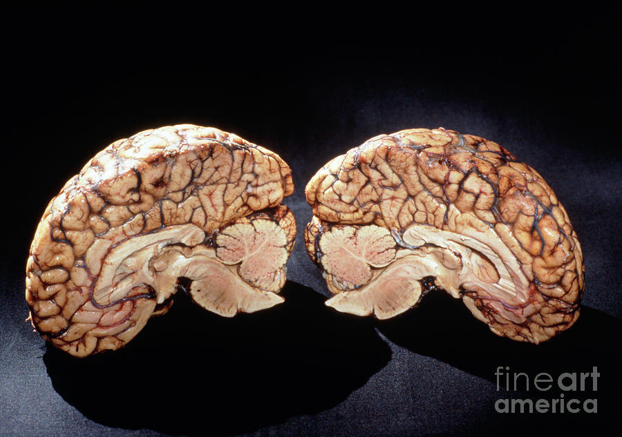Healthy Human Brain Cut In Two (sagittal Section) Photograph by Geoff Tompkinson/science Photo Library