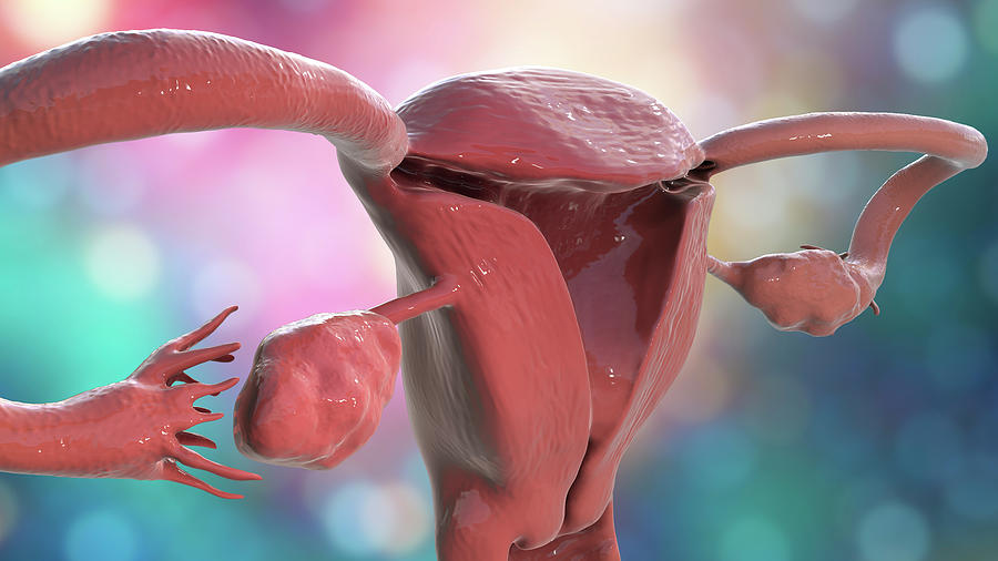 Healthy Ovary And Fallopian Tube Photograph by Kateryna Kon