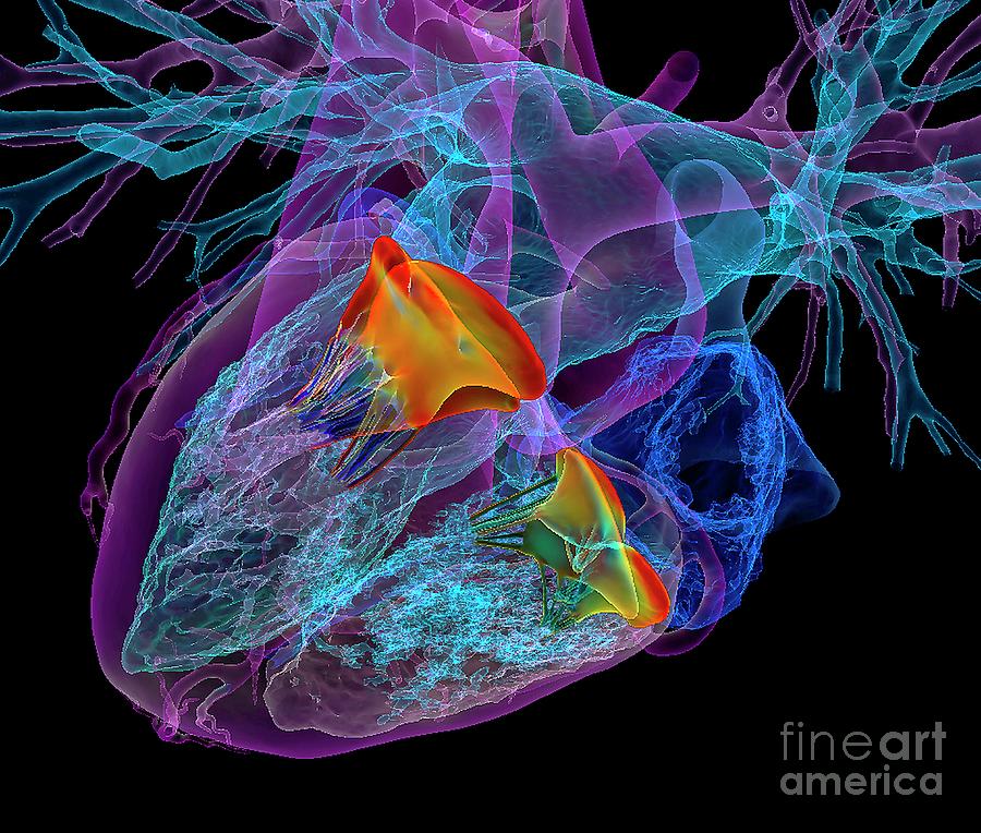 Heart And Its Valves Photograph by K H Fung/science Photo Library