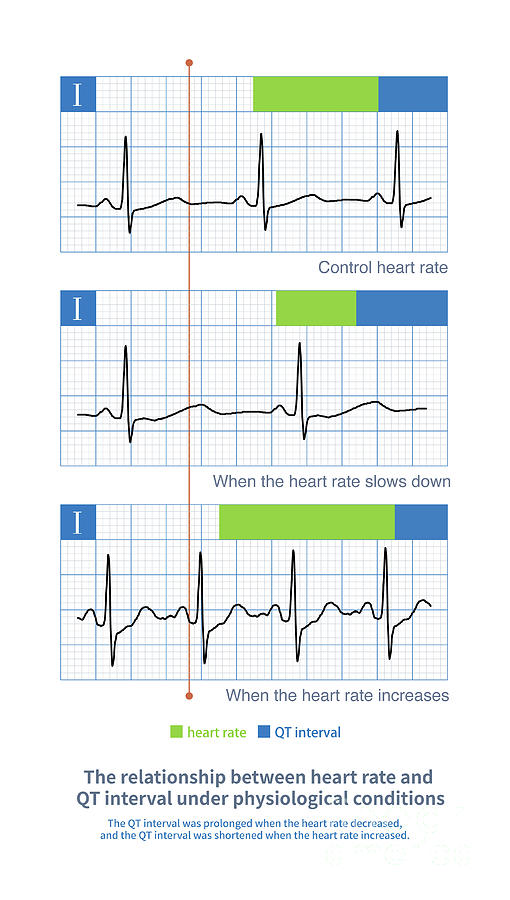 Heart Rate And Qt Interval Photograph By Chongqing Tumi Technology Ltd Science Photo Library