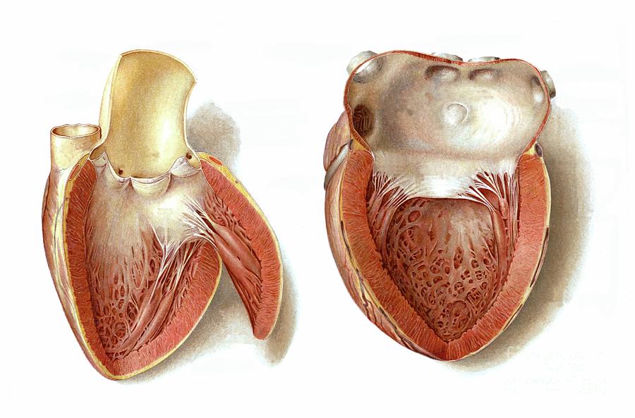 Heart Ventricle Photograph by Microscape/science Photo Library