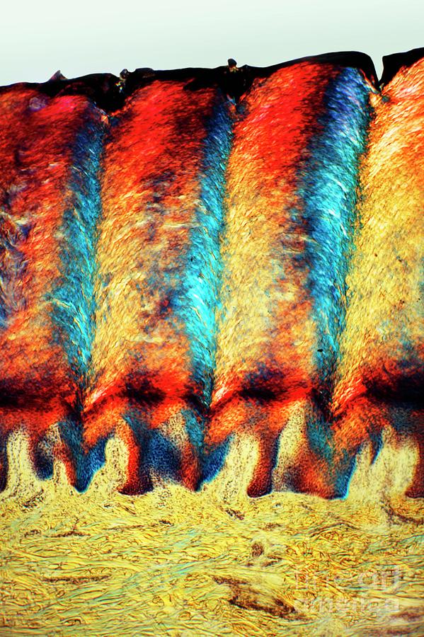 Heel Skin Tissue Photograph by Dr Keith Wheeler/science Photo Library