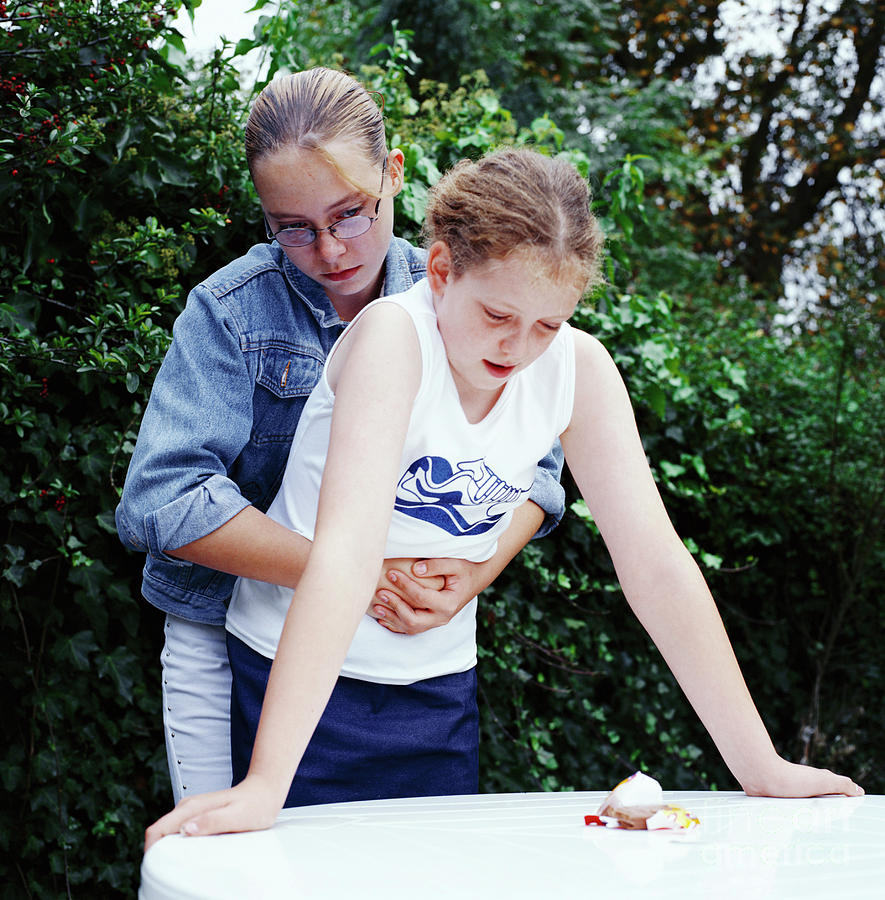 Heimlich Manoeuvre Photograph by Faye Norman/science Photo Library ...