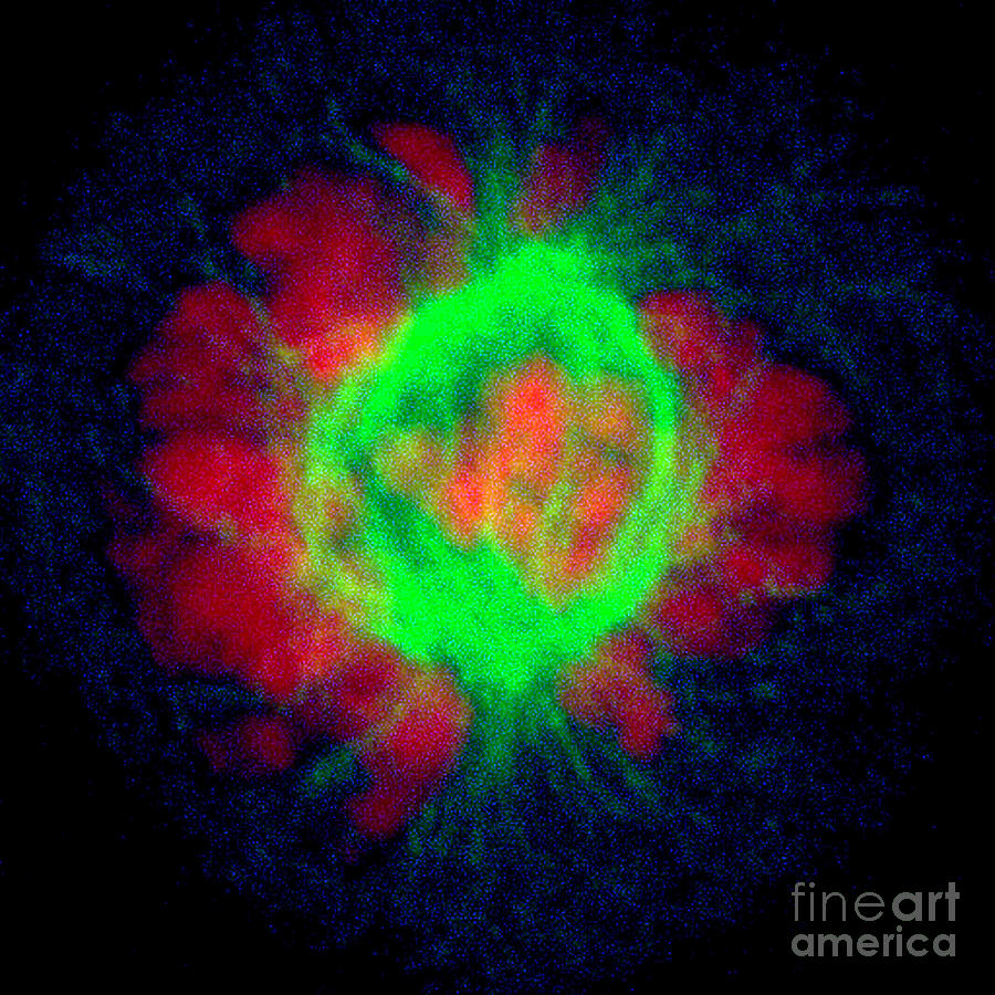 Hela Cell In Prometaphase Photograph by Dr Matthew Daniels/science Photo Library
