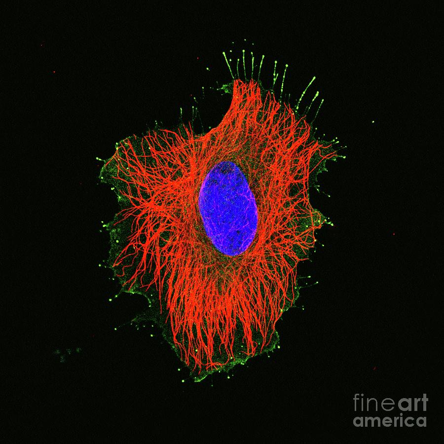 Hela Cell Photograph by National Institutes Of Health/science Photo Library