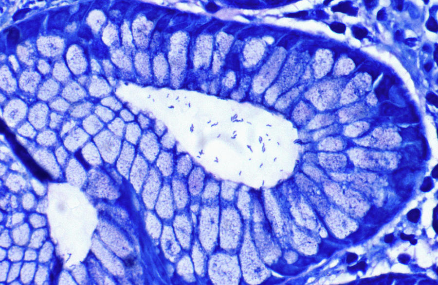 Helicobacter Pylori In Antral Crypt Photograph by michael J. Klein, M.d.