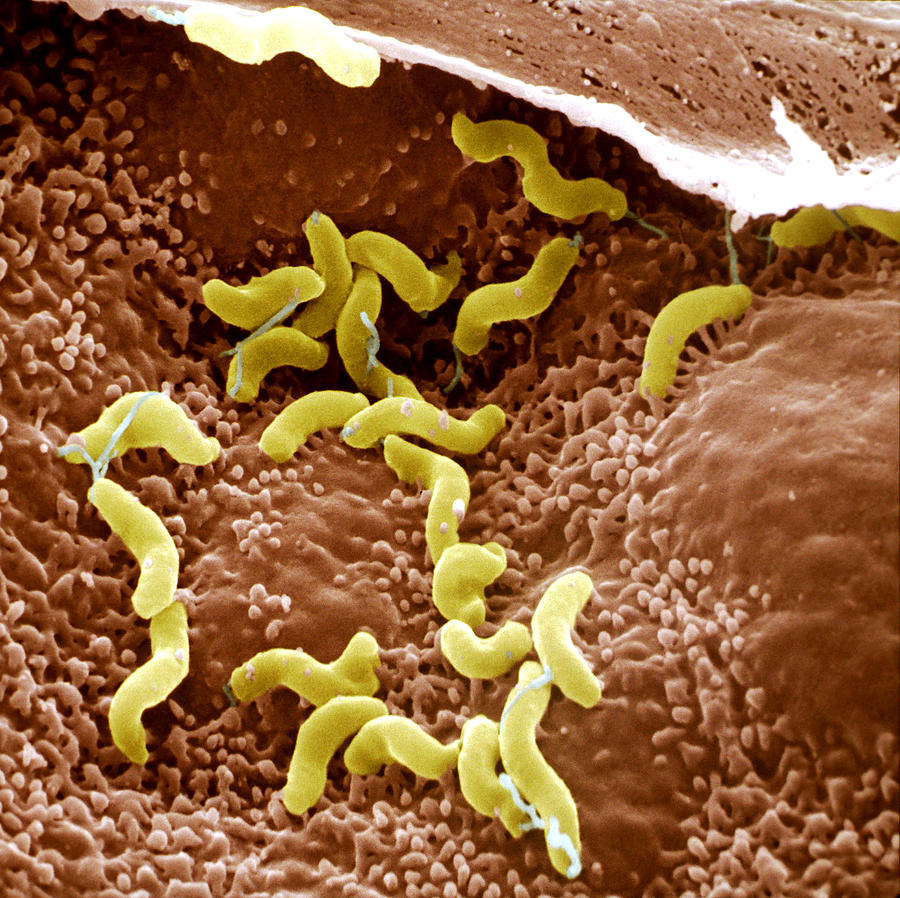 Helicobacter Pylori Photograph by Meckes/ottawa