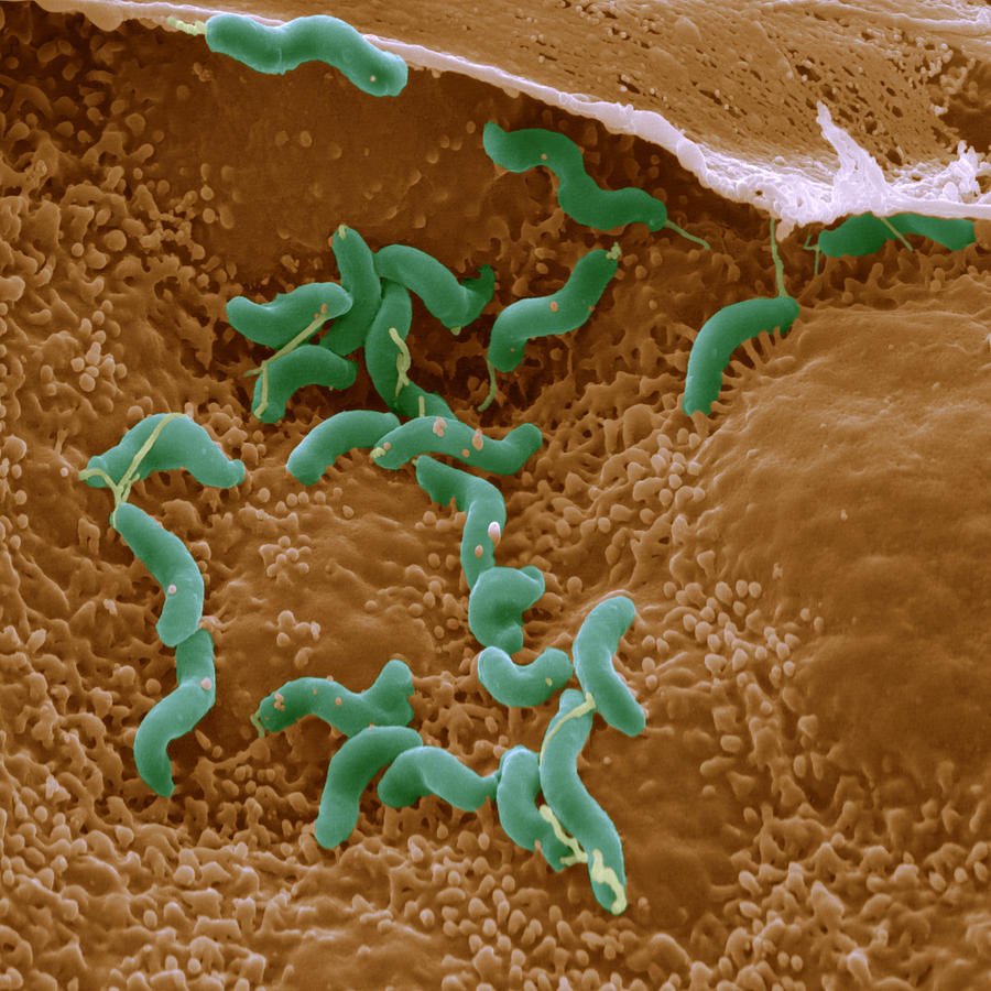 Helicobacter Pylori Photograph by Oliver Meckes EYE OF SCIENCE